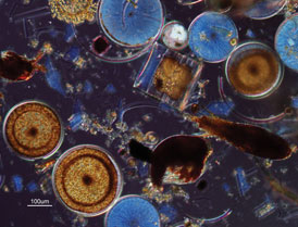사진 1. 돌말류의 현미경 사진