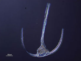 사진 3. 와편모조류의 현미경 사진
