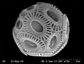 사진 4. 착편모조류의 전자현미경 사진