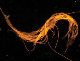 사진 5. 사상체형 남세균의 형광현미경 사진